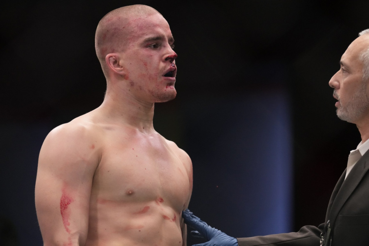 NIJE MU BILO SPASA! Ovako je Duško Todorović pobedio protivnika (VIDEO)