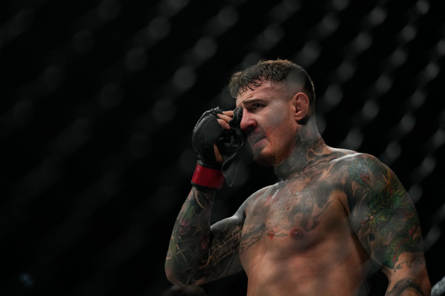 UFC ŠAMPION ZAVRŠIO U BOLNICI POSLE HOROR UBODA U OKO!