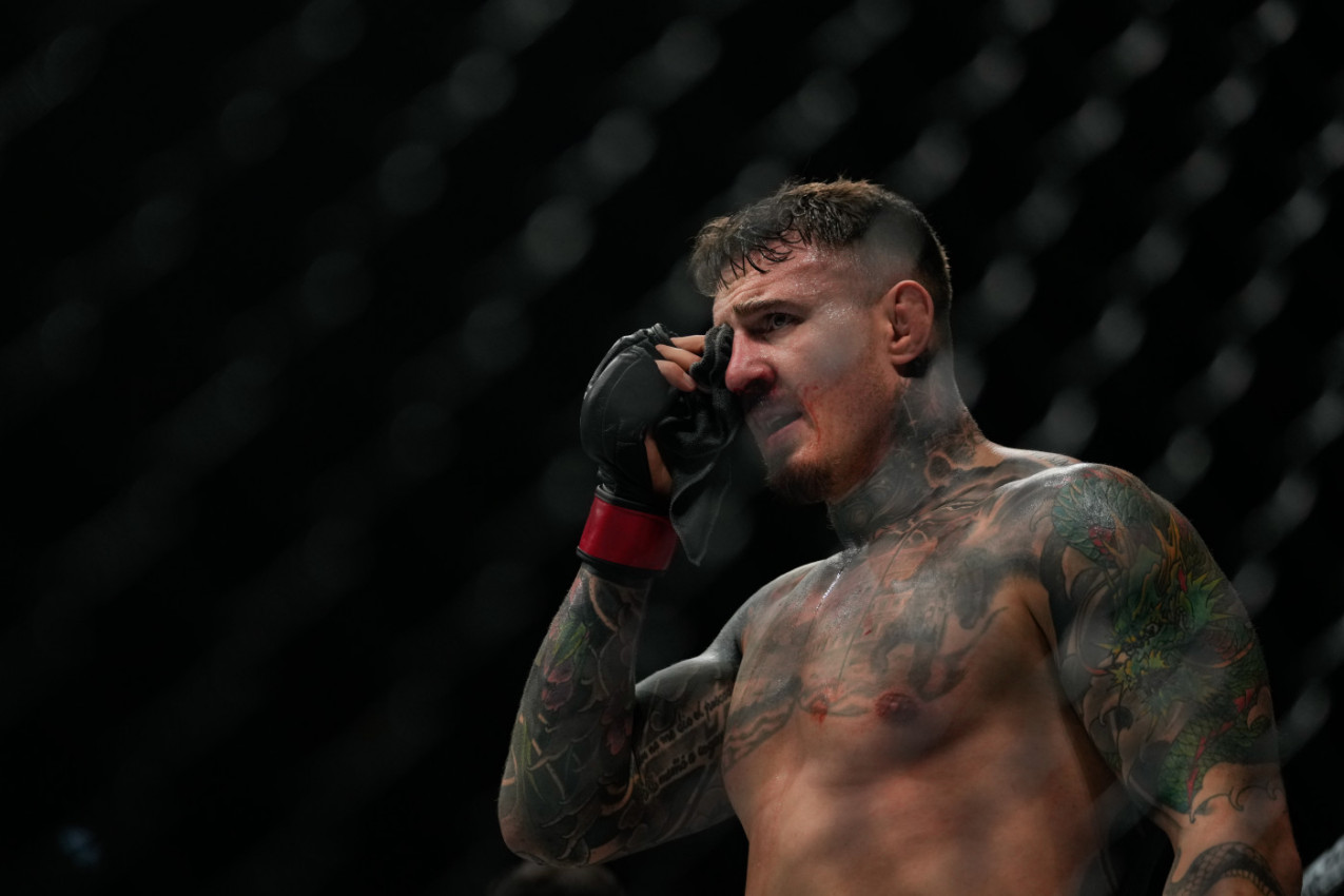 UFC ŠAMPION ZAVRŠIO U BOLNICI POSLE HOROR UBODA U OKO! UFC ŠAMPION ZAVRŠIO U BOLNICI POSLE HOROR UBODA U OKO!