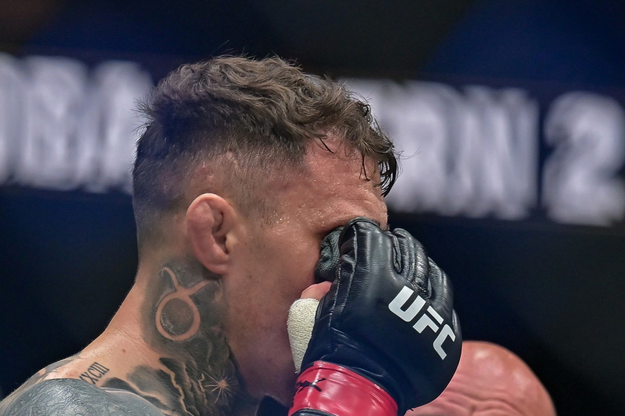 JEZIVO: Borac bi mogao da ostane SLEP nakon povrede u oktagonu! (UZNEMIRUJUĆI VIDEO) JEZIVO: Borac bi mogao da ostane SLEP nakon povrede u oktagonu! (UZNEMIRUJUĆI VIDEO)