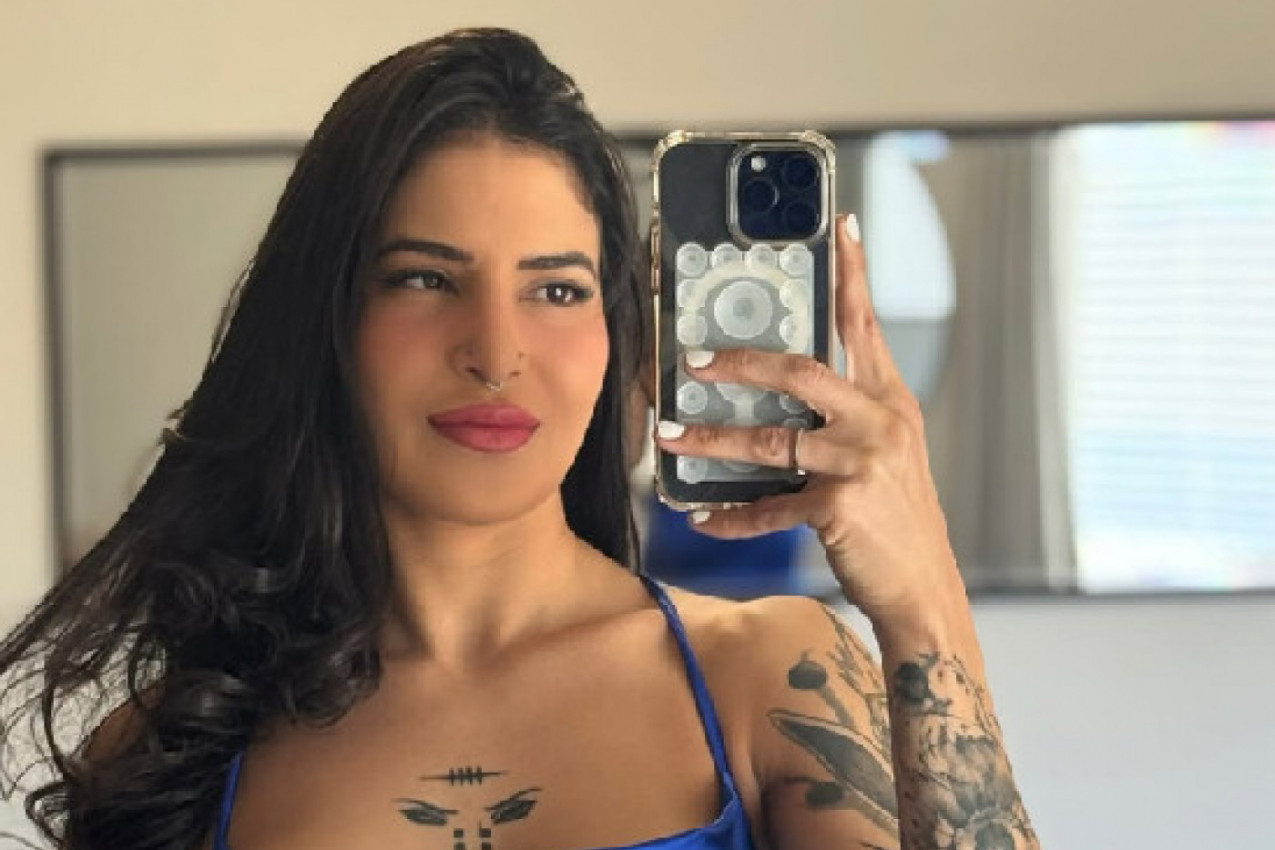 ŠTA SE DOGODILO S NJOM? Atraktivna Vijana sva u modricama! (FOTO)