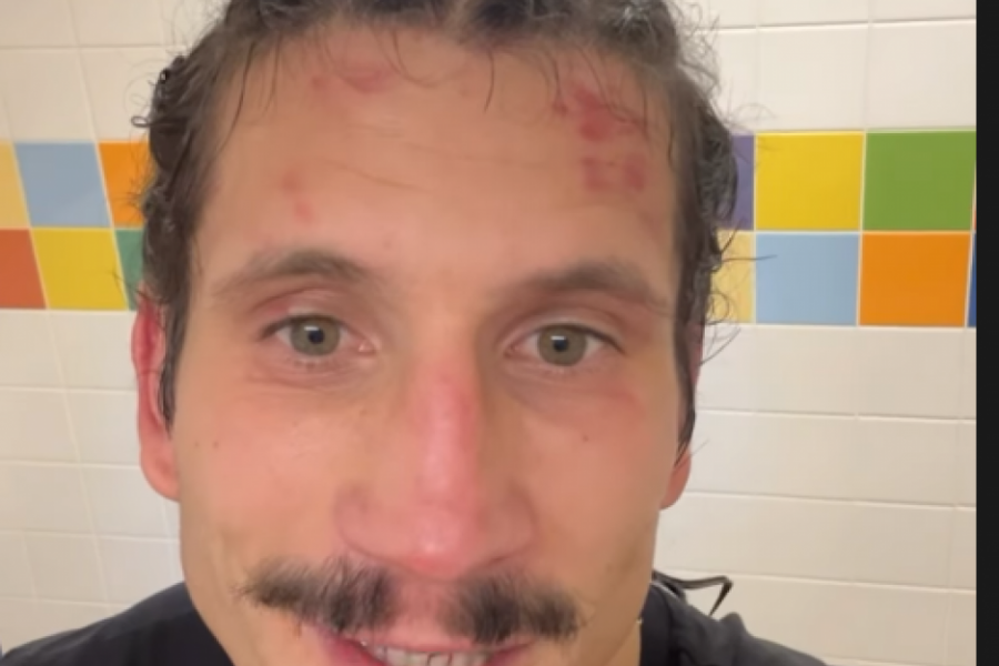 ZA SVAKU POHVALU: Miloš Cvjetićanin na gospodski način odjavio borbu Glory turnira!